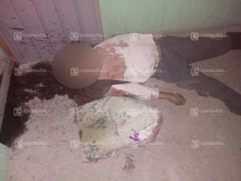 Le destrozan la cabeza adulto mayor afuera de su domicilio para intentarle robar imagen 3