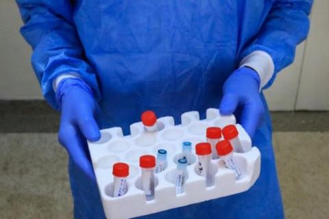 Gobierno de EEUU afirma que el covid-19 fue creado en un laboratorio chino y tiene pruebas