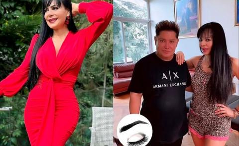 Maribel Guardia nuevamente se hizo un “arreglito” en el rostro y lo presumió en redes