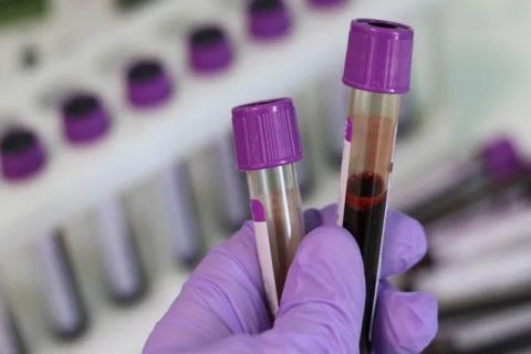 Algunos diferentes tipos de sangre son más vulnerables ante el Covid-19