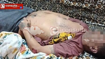 Muere hombre tras presunta golpiza en anexo; familiares piden esclarecimiento