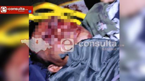 Ataque directo en Zacatelco deja a joven con impacto de bala en la cabeza