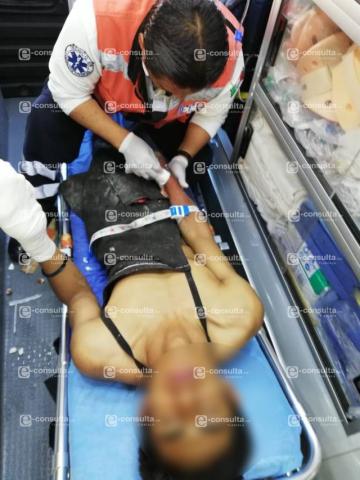 Trabajador de una tortillería pierde dos dedos al limpiar la maquina en Nativitas imagen 2