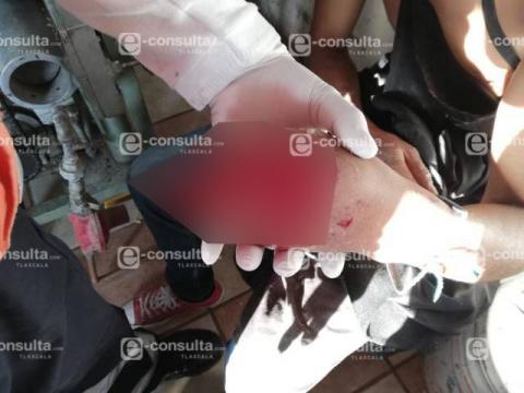 Trabajador de una tortillería pierde dos dedos al limpiar la maquina en Nativitas imagen 4