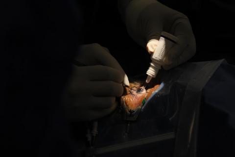 Inicia campaña de cirugías de cataratas y de mínima invasión  imagen 7
