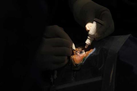 Inicia campaña de cirugías de cataratas y de mínima invasión  imagen 1